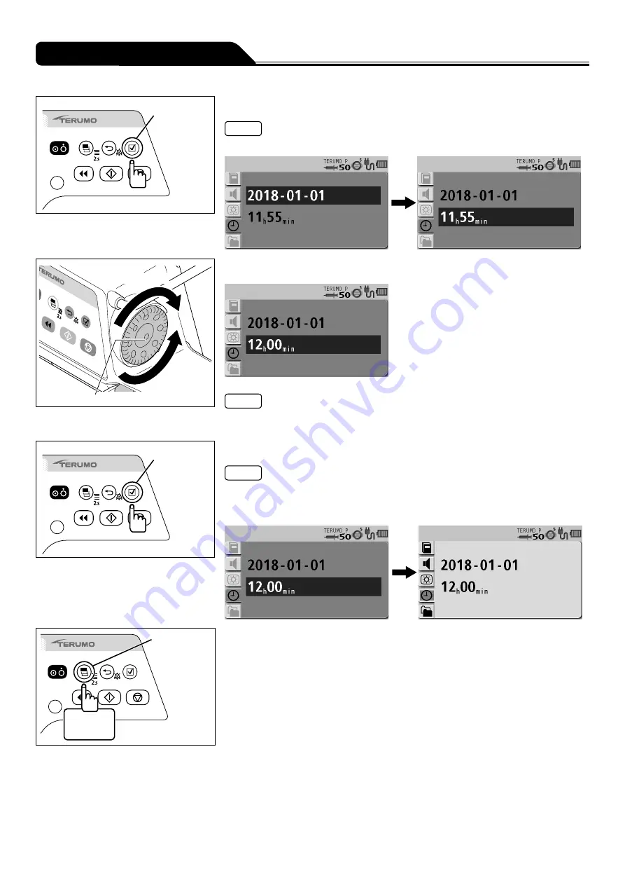 Terumo TERUFUSION TE-SS730 Instruction Manual Download Page 212