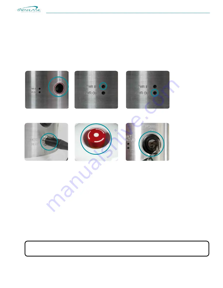 THERALASE TLC-2000 Series Operation Manual Download Page 11