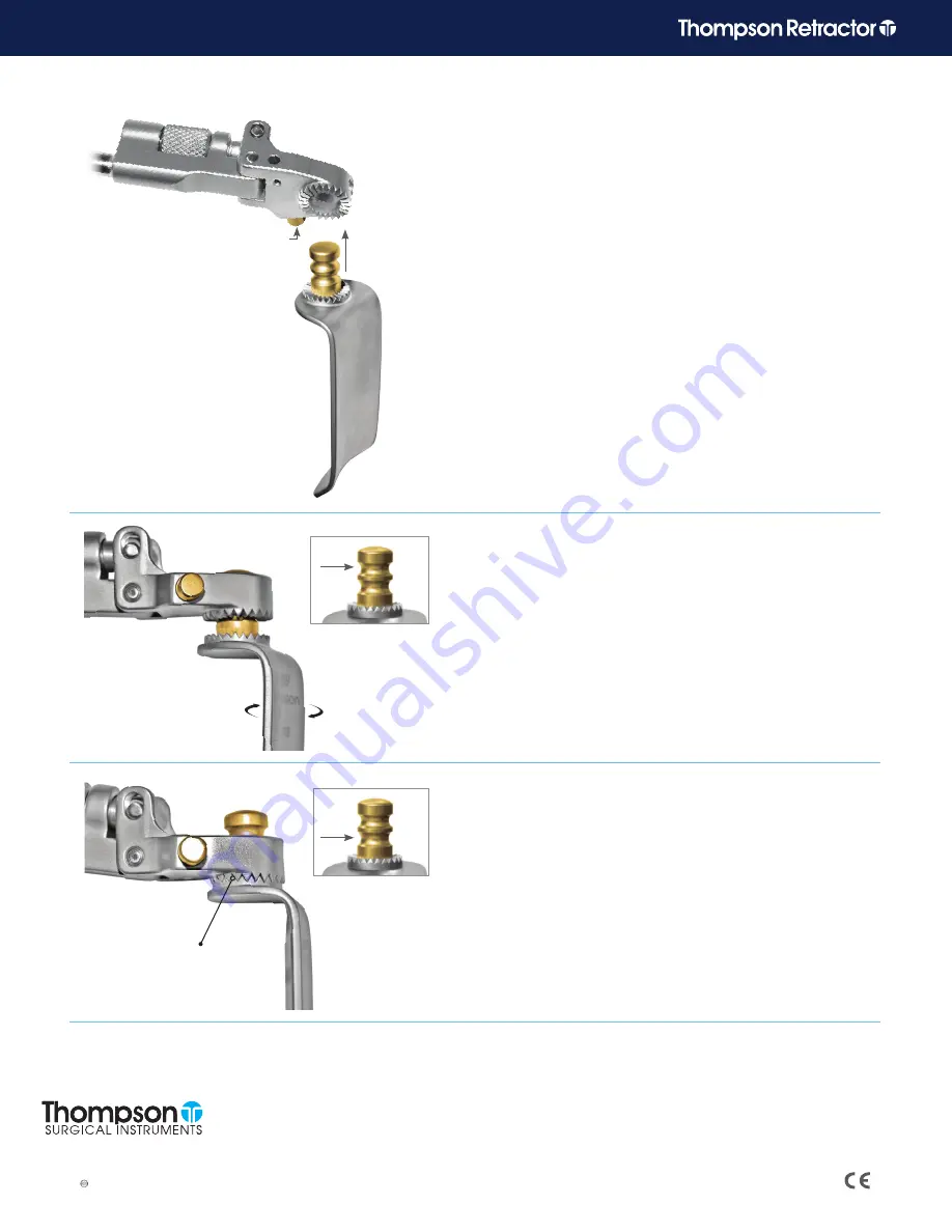 Thompson Retractor S-Lock Скачать руководство пользователя страница 2