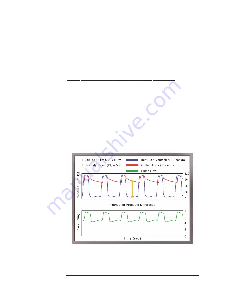 Thoratec HeartMate II LVAS Manual Download Page 10