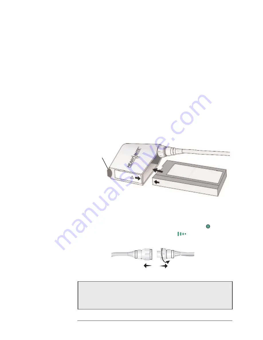 Thoratec HeartMate II LVAS Manual Download Page 31