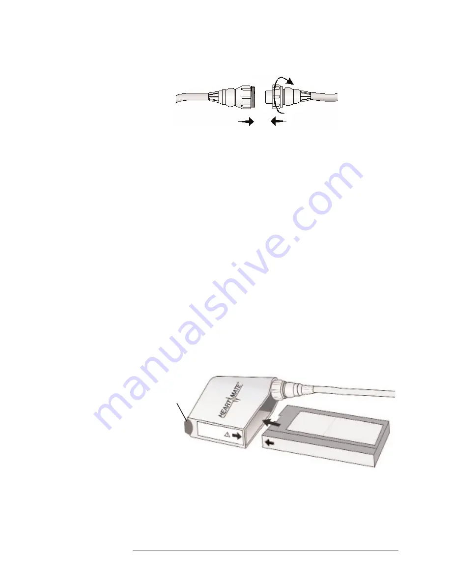 Thoratec HeartMate II LVAS Manual Download Page 34