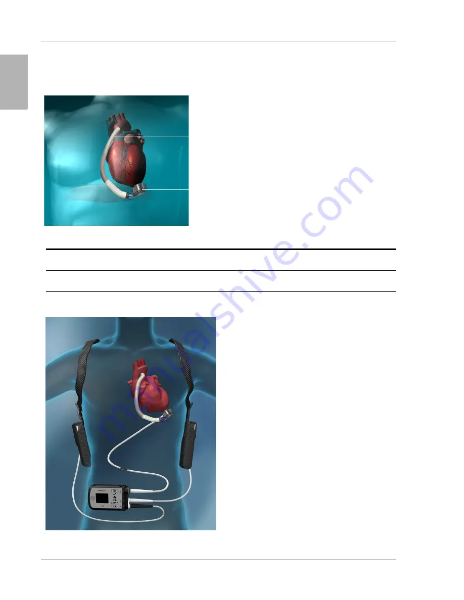 Thoratec HeartMate III Instructions For Use Manual Download Page 32