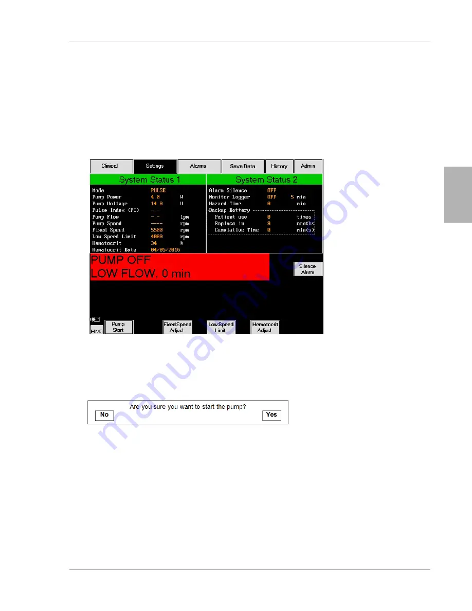 Thoratec HeartMate III Instructions For Use Manual Download Page 187