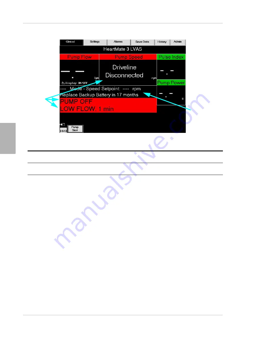 Thoratec HeartMate III Instructions For Use Manual Download Page 228