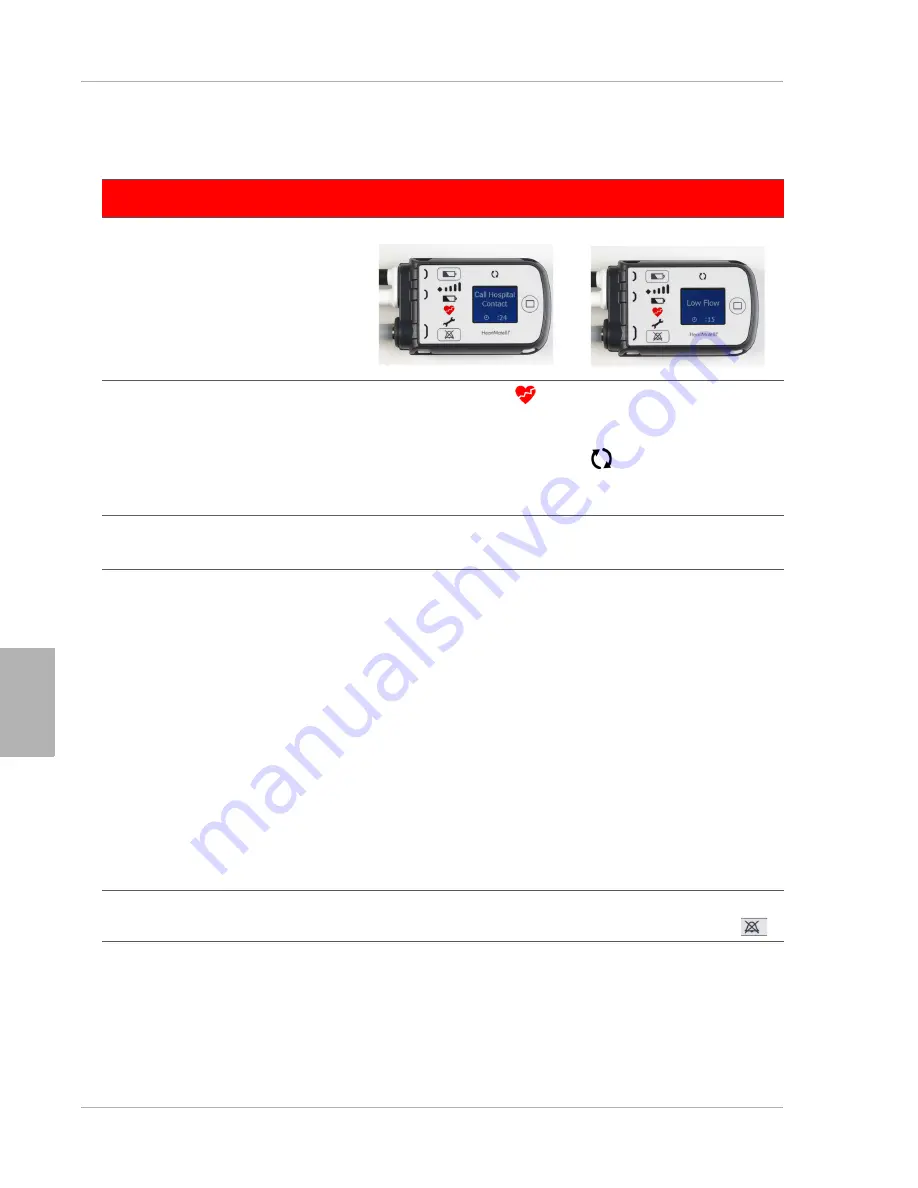 Thoratec HeartMate III Instructions For Use Manual Download Page 338