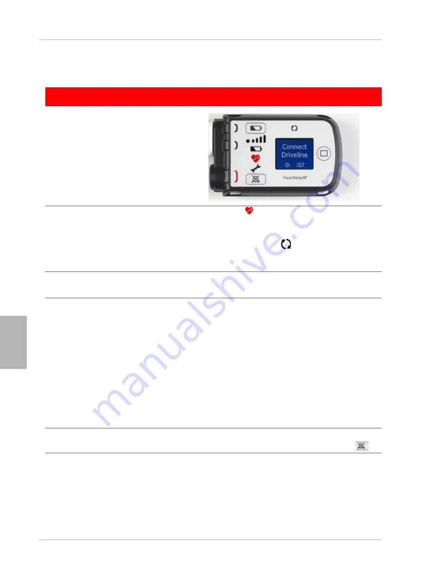 Thoratec HeartMate III Скачать руководство пользователя страница 340