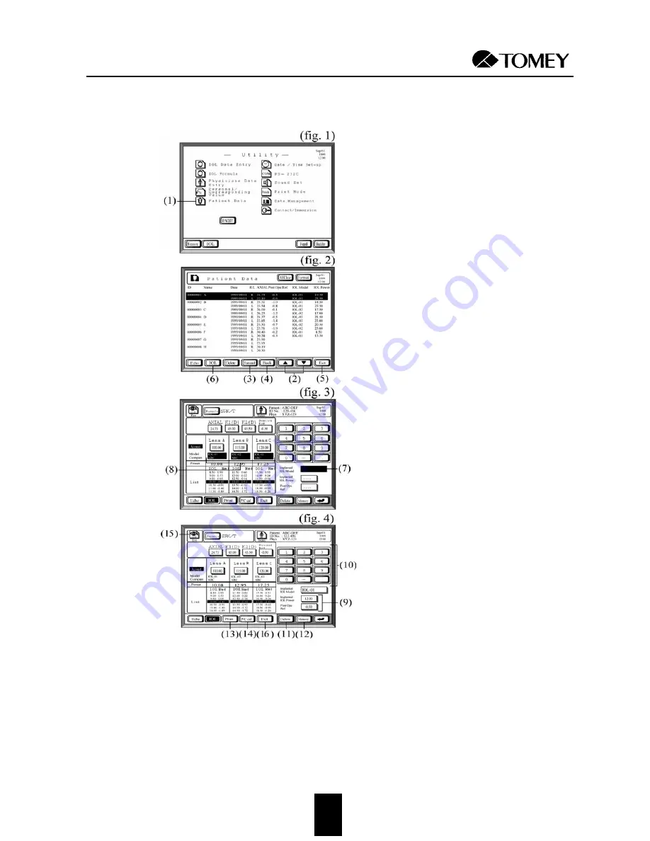 Tomey AL-2000 Operator'S Manual Download Page 70