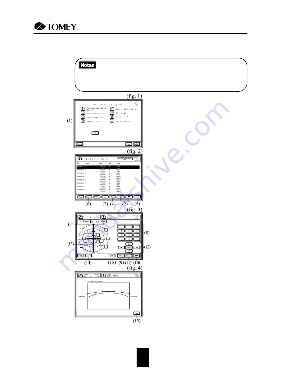 Tomey AL-2000 Operator'S Manual Download Page 77