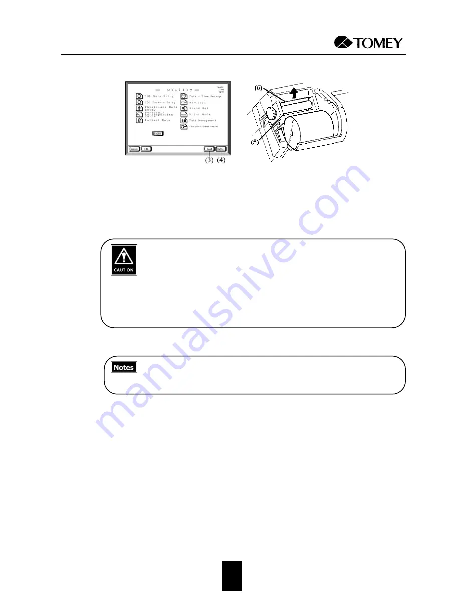 Tomey AL-2000 Operator'S Manual Download Page 104