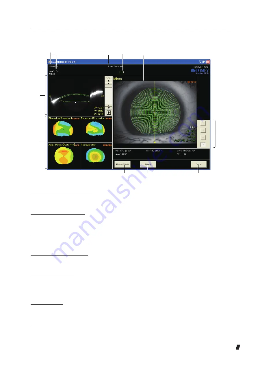 Tomey TMS-5 Instruction Manual Download Page 41