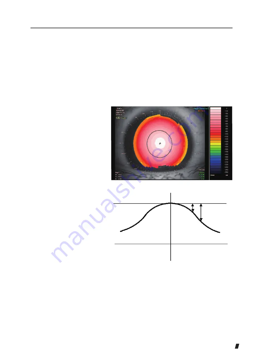 Tomey TMS-5 Instruction Manual Download Page 101