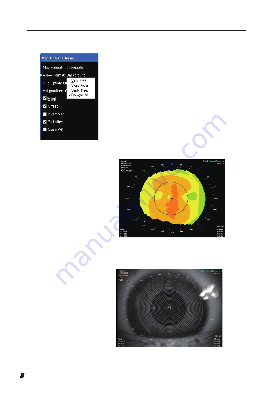 Tomey TMS-5 Скачать руководство пользователя страница 132