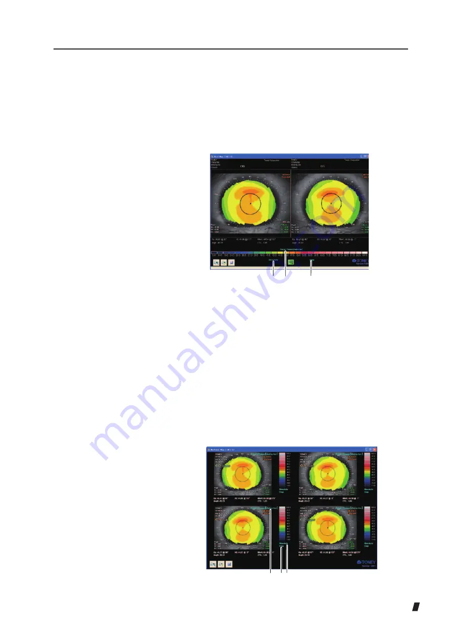 Tomey TMS-5 Instruction Manual Download Page 143