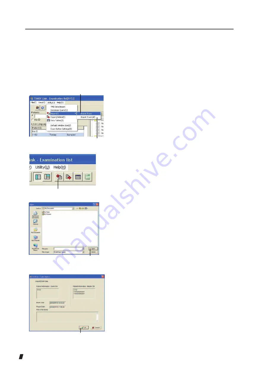 Tomey TMS-5 Instruction Manual Download Page 162