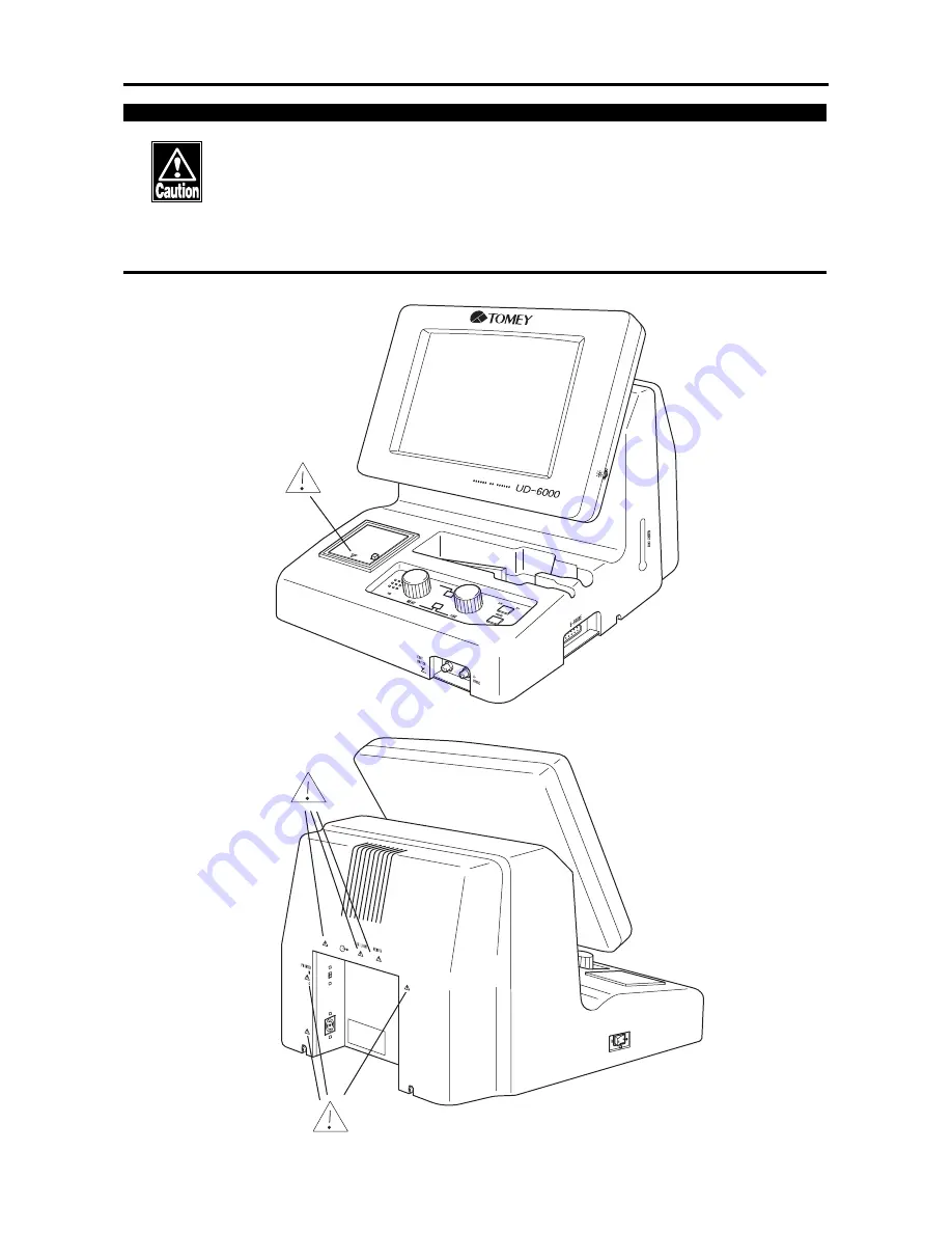 Tomey UD-600 Operator'S Manual Download Page 4