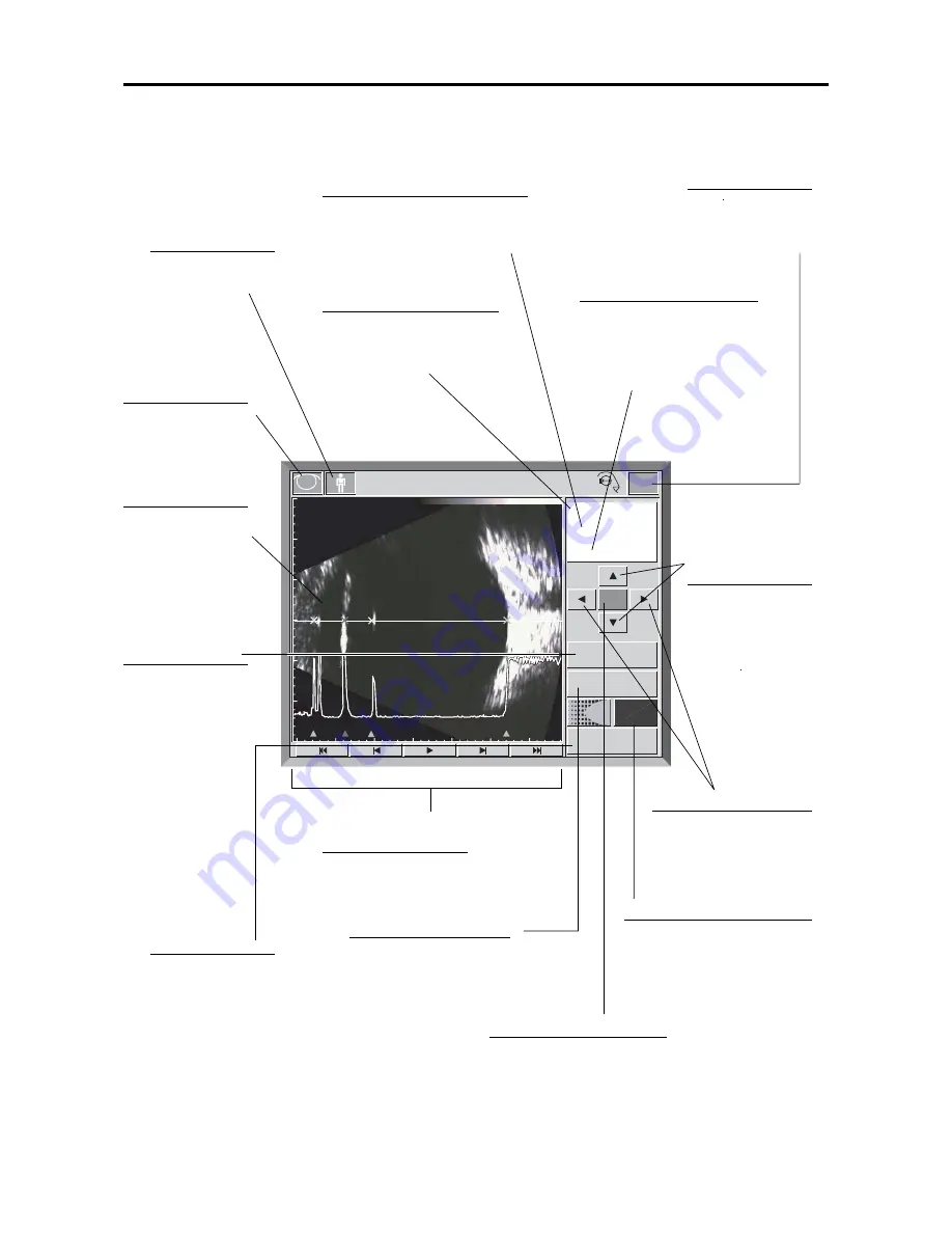 Tomey UD-600 Operator'S Manual Download Page 91