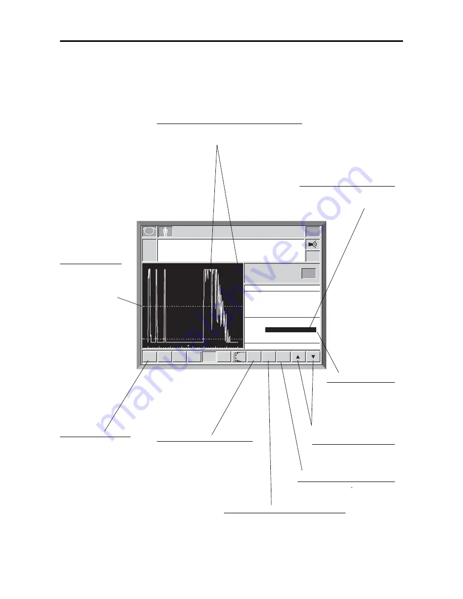 Tomey UD-600 Operator'S Manual Download Page 120