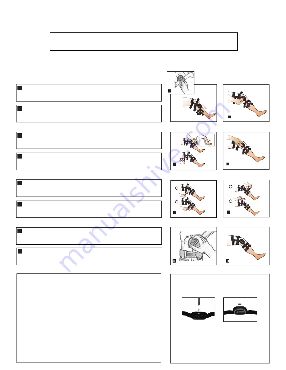 Top shelf Orthopedics Knight OA Скачать руководство пользователя страница 2