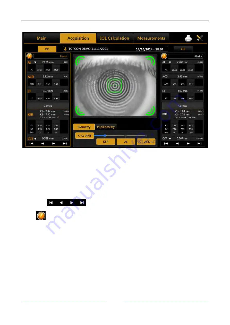 Topcon ALADDIN HW3.0 User Manual Download Page 47