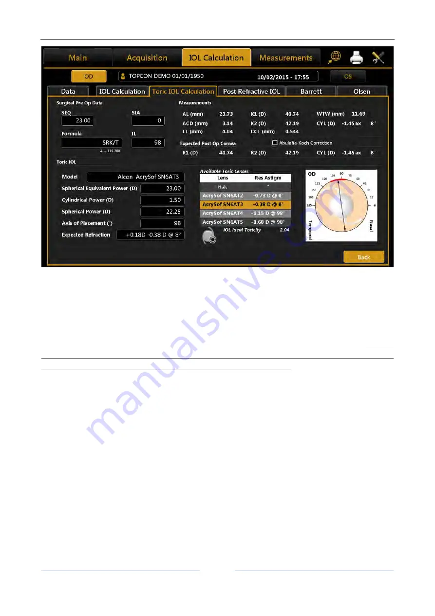 Topcon ALADDIN HW3.0 User Manual Download Page 69