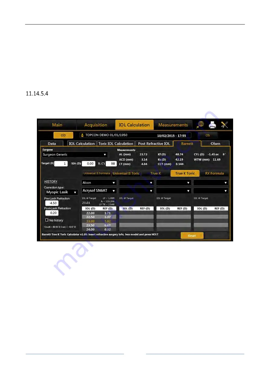 Topcon ALADDIN HW3.0 User Manual Download Page 78