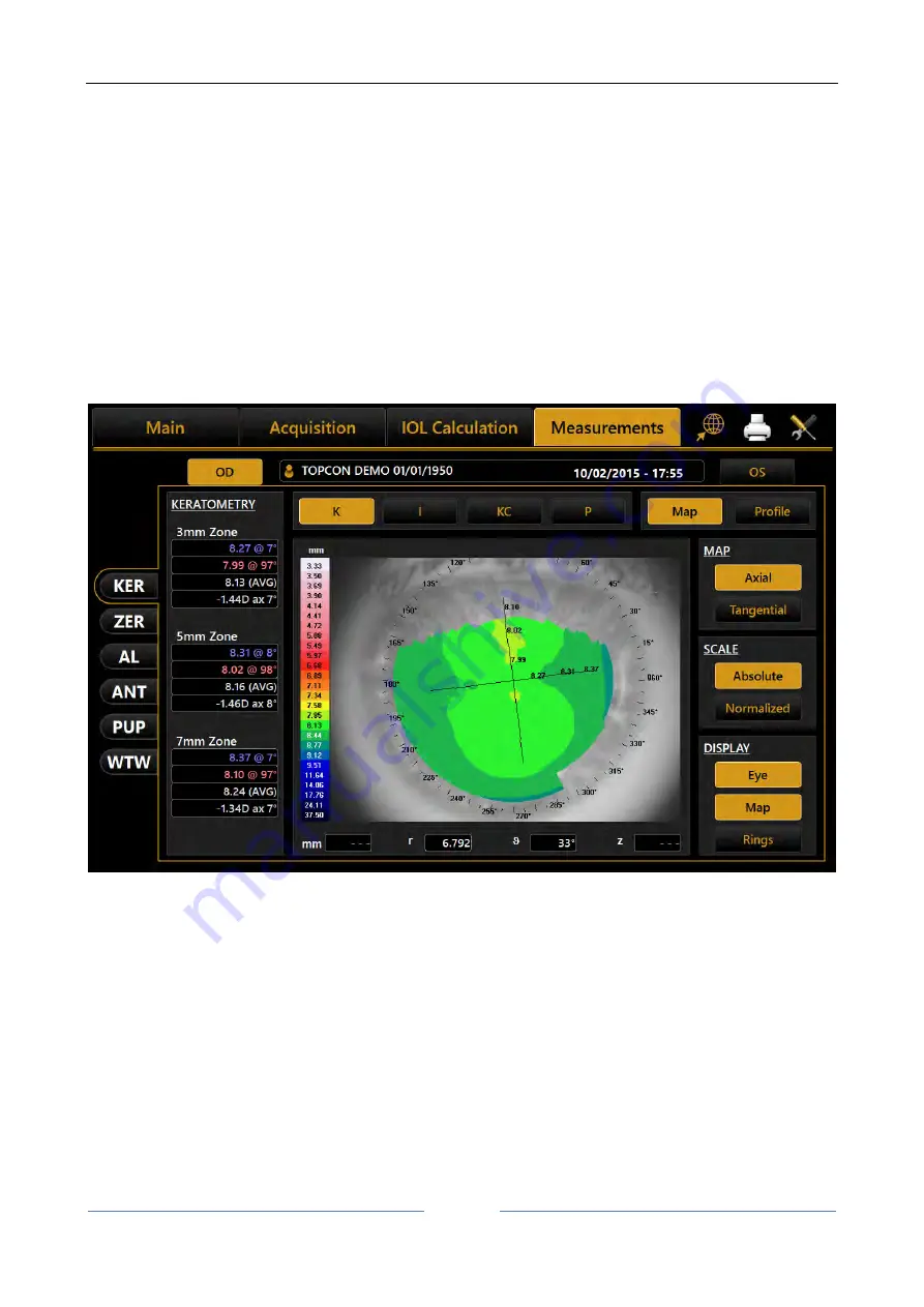 Topcon ALADDIN HW3.0 User Manual Download Page 99