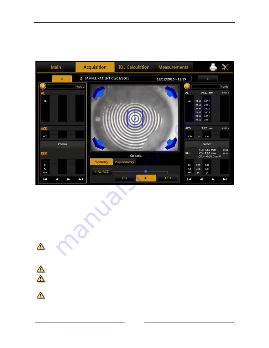 Topcon ALADDIN Скачать руководство пользователя страница 57