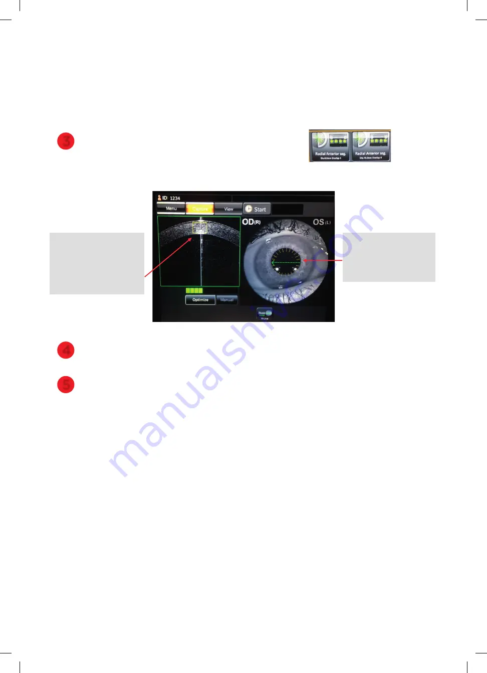 Topcon DRI OCT Triton Quick Reference Manual Download Page 10