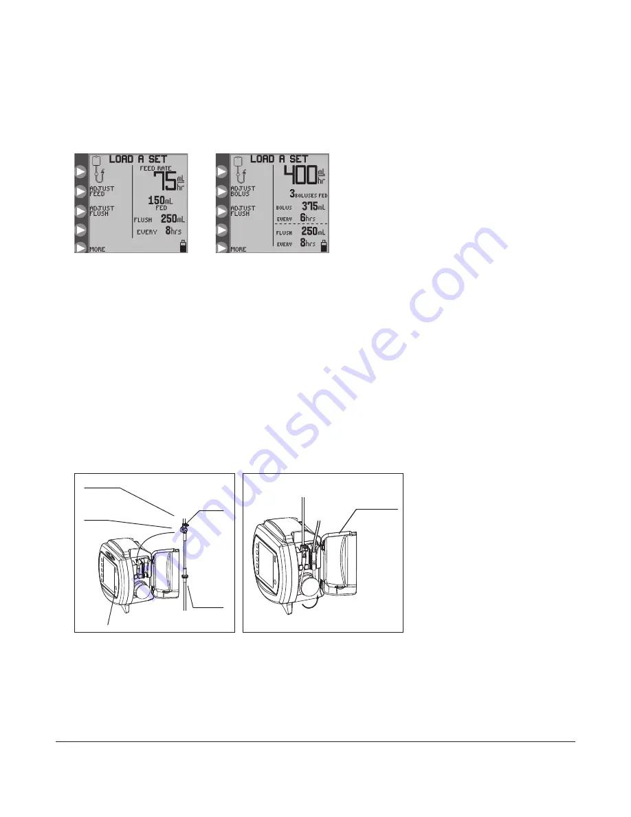 Tyco kENDALL KANGAROO ePump Operation And Service Manual Download Page 14