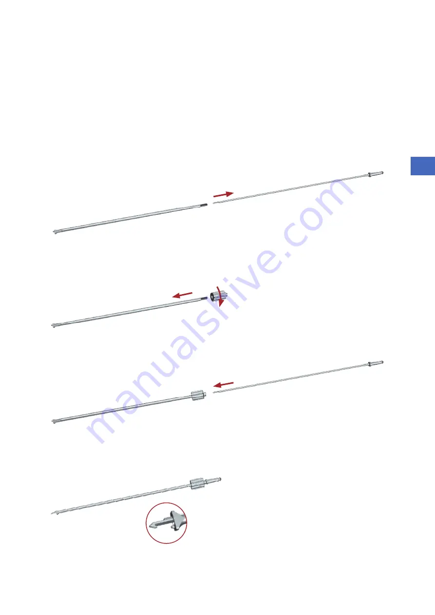 ulrich medical Pezo PEEK cage Series Assembly And Disassembly Instructions With Special Cleaning Instructions Download Page 9