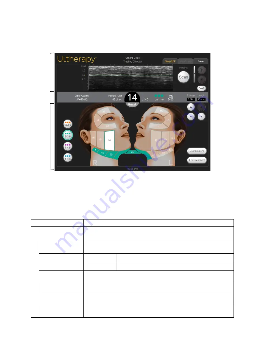 Ulthera DeepSEE DS 10 -1.5 Скачать руководство пользователя страница 44