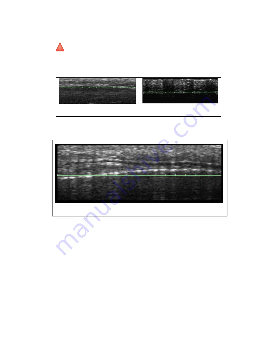 Ulthera DeepSEE DS 10 -1.5 Instructions For Use Manual Download Page 53