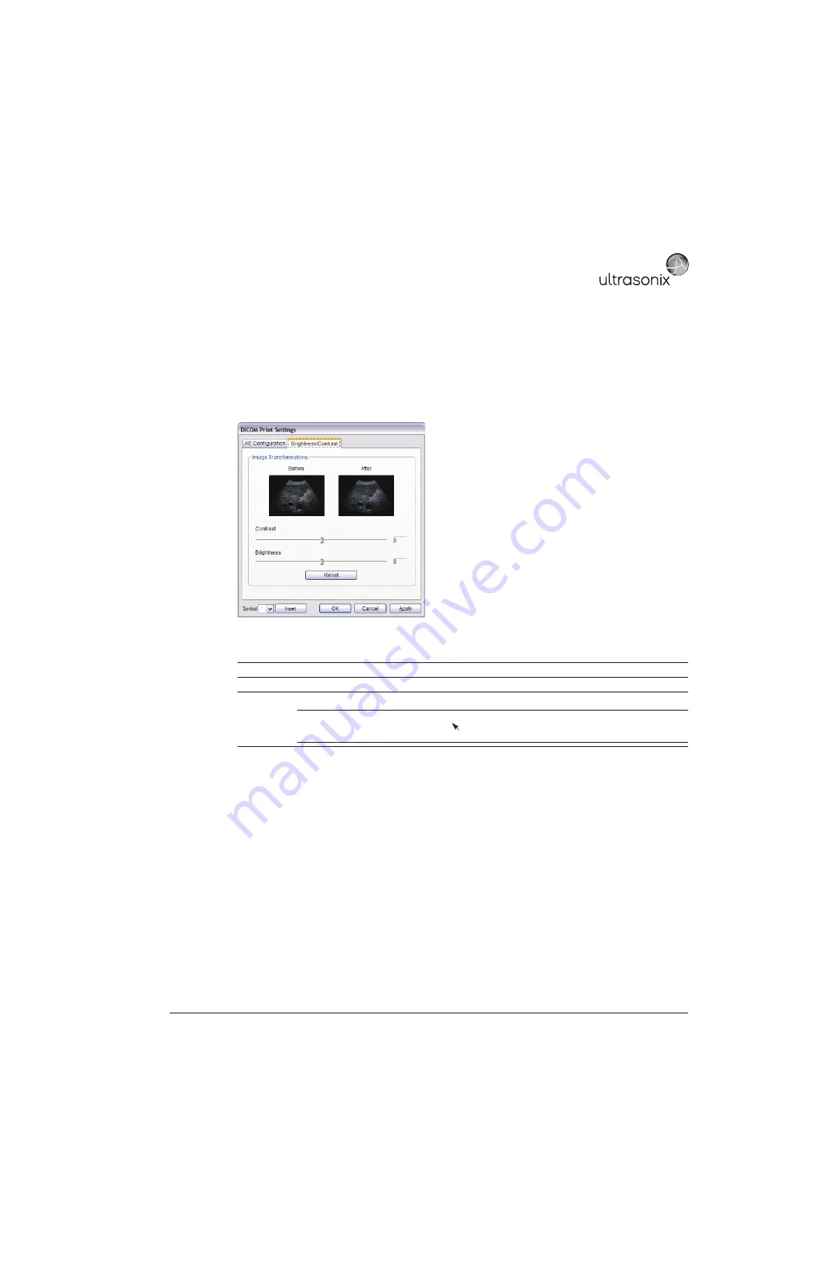 Ultrasonix SonixMDP Service Manual Download Page 115