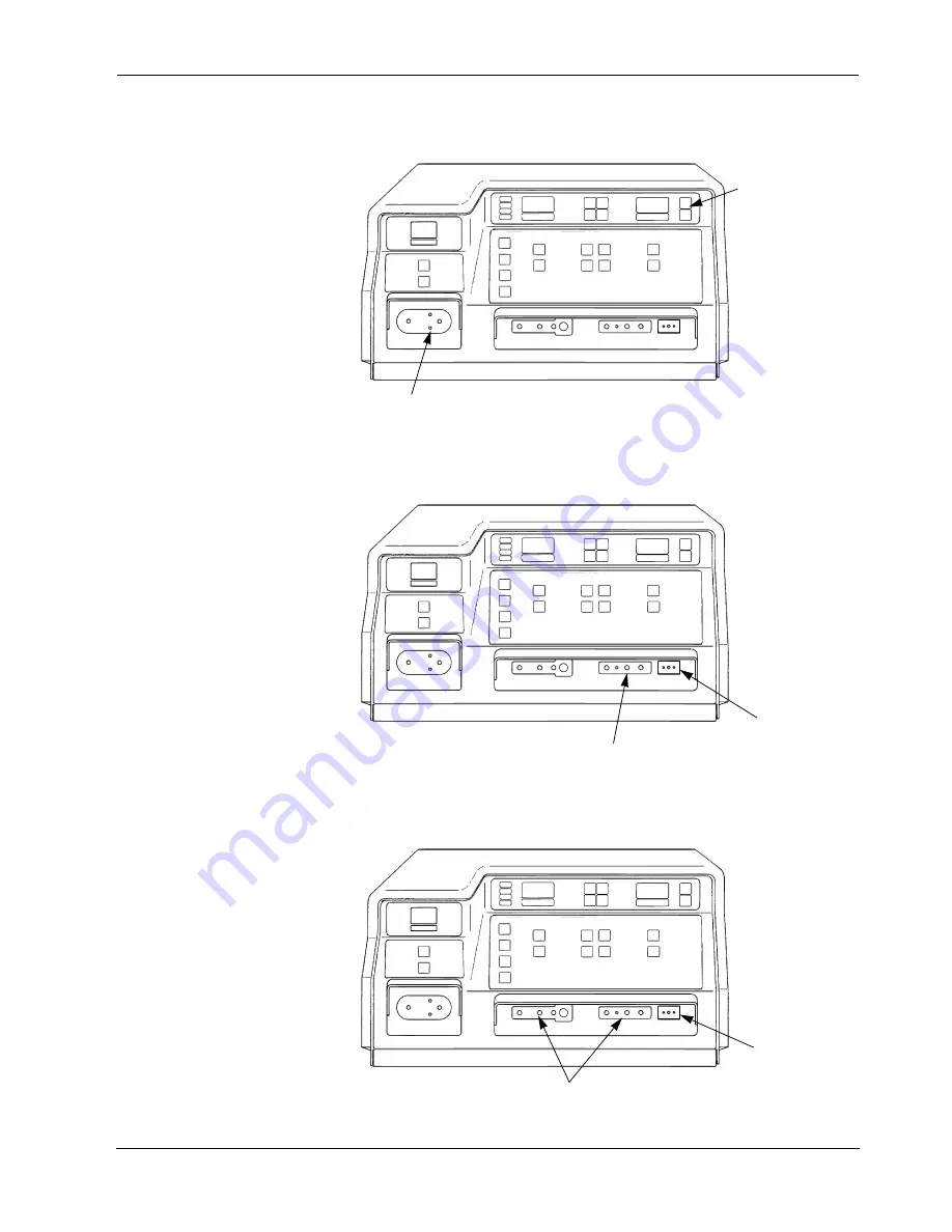 Valleylab Force 2 User Manual Download Page 32