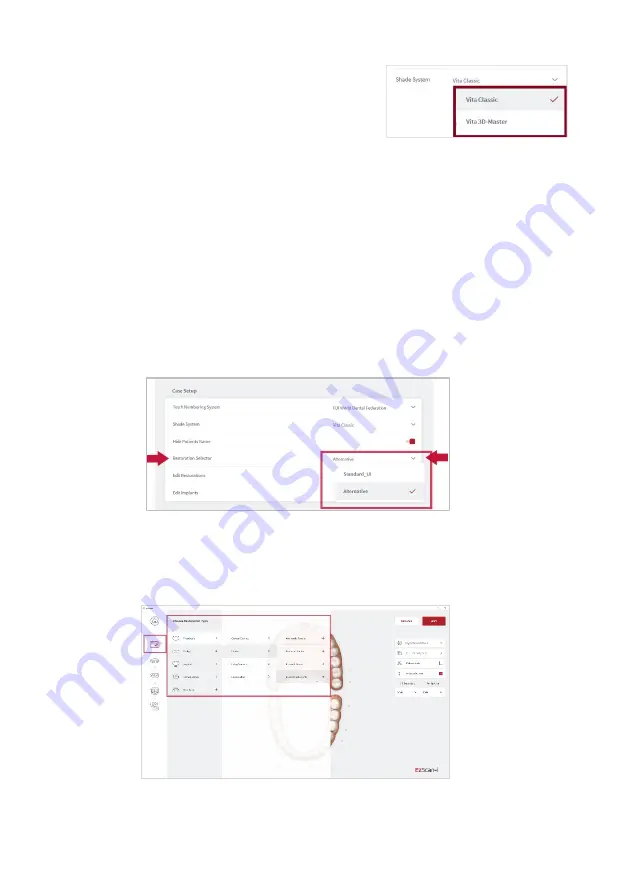 Vatech EzScan-i User Manual Download Page 31