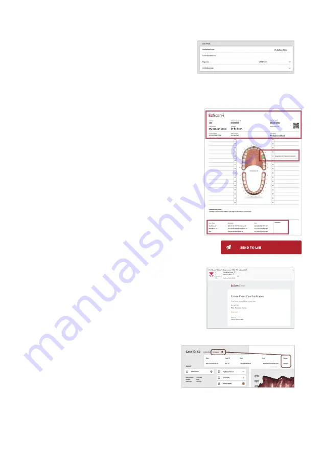 Vatech EzScan-i User Manual Download Page 69