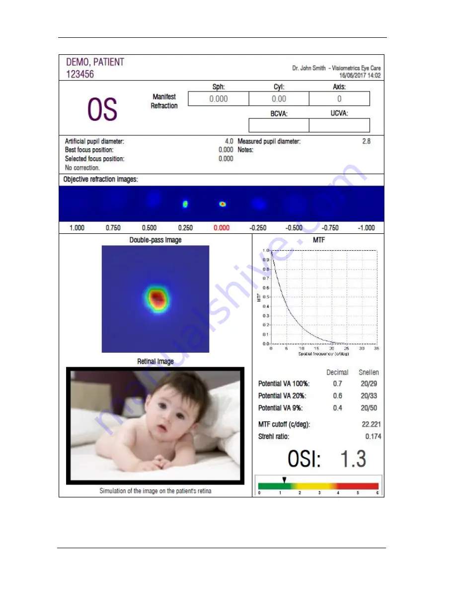 Visiometrics HD Analyzer OQAS User Manual Download Page 80