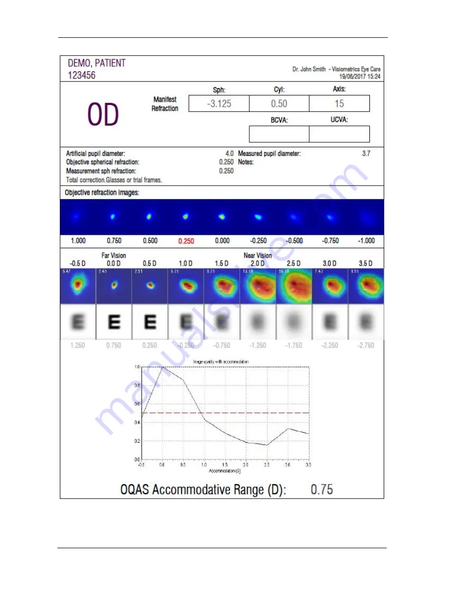 Visiometrics HD Analyzer OQAS User Manual Download Page 82