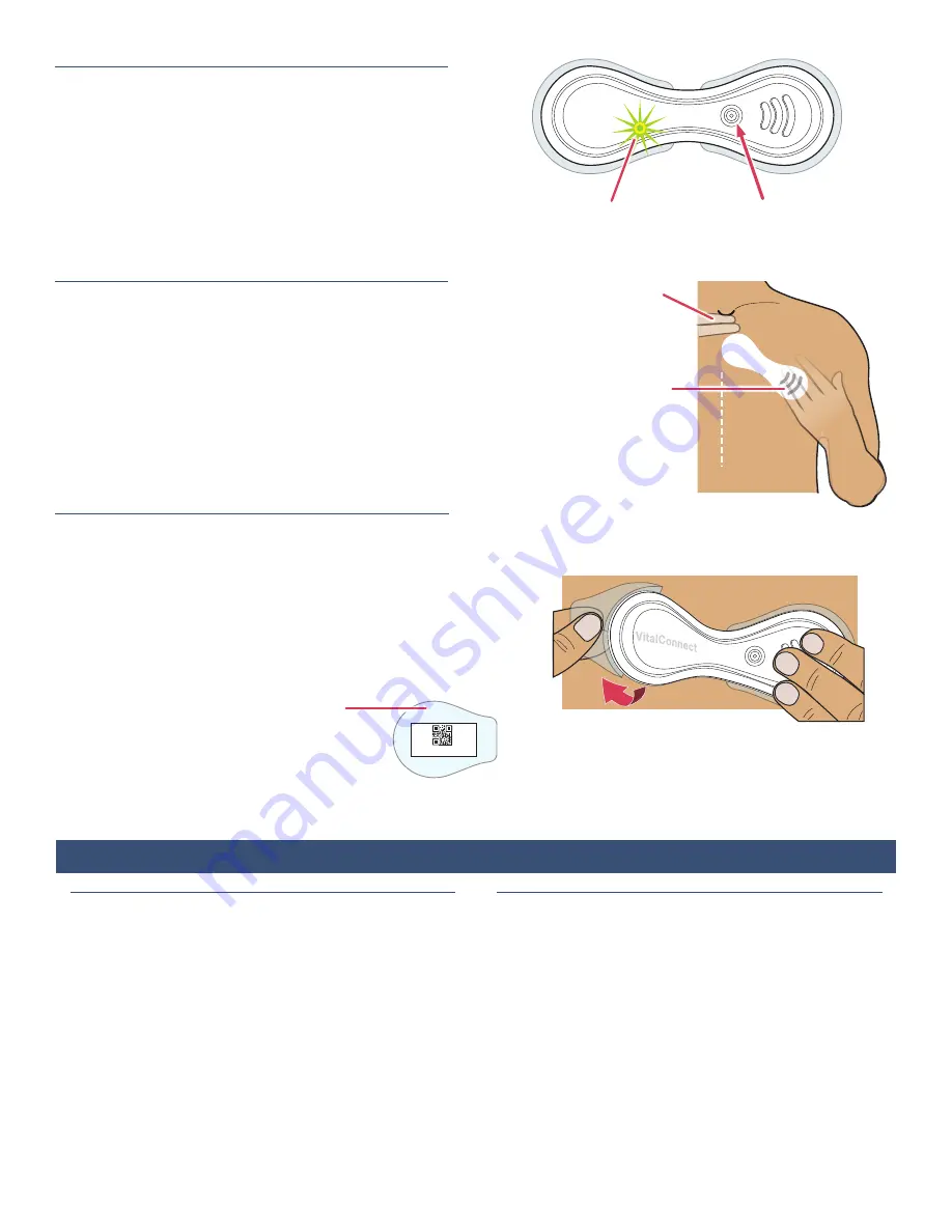 VitalConnect VistaPoint 3.1 Quickstart And Instructions For Use Download Page 5