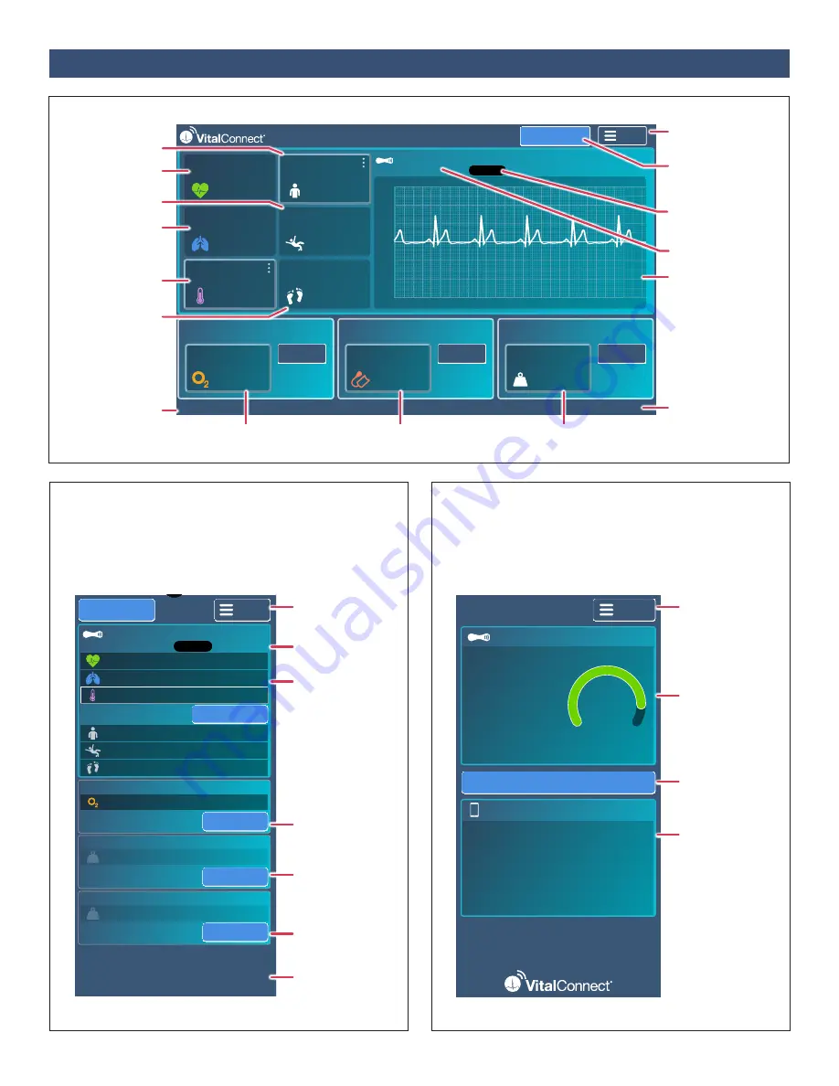 VitalConnect VistaPoint 3.2 Instructions For Use Manual Download Page 14