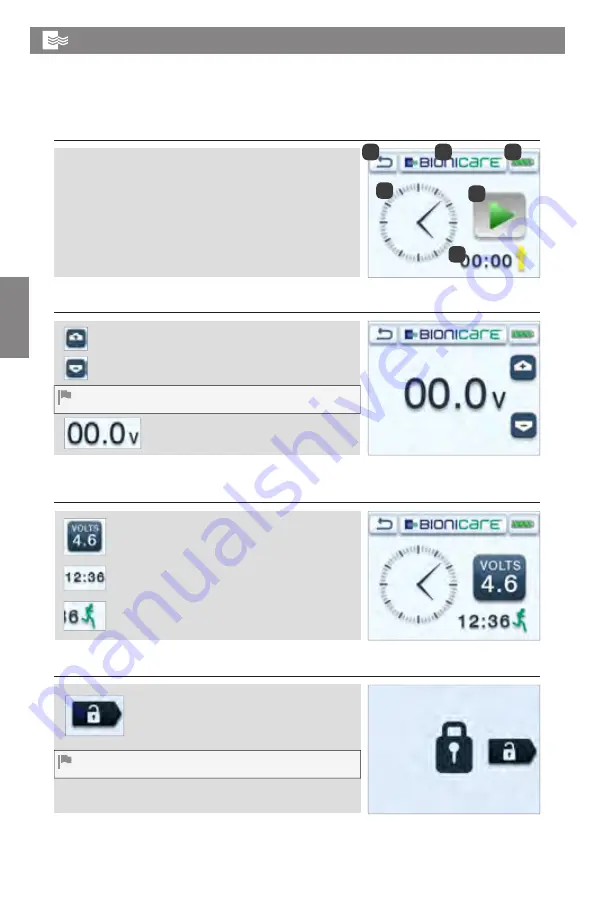 VQ OrthoCare BIONICARE KNEE SYSTEM Operating Manual Download Page 52