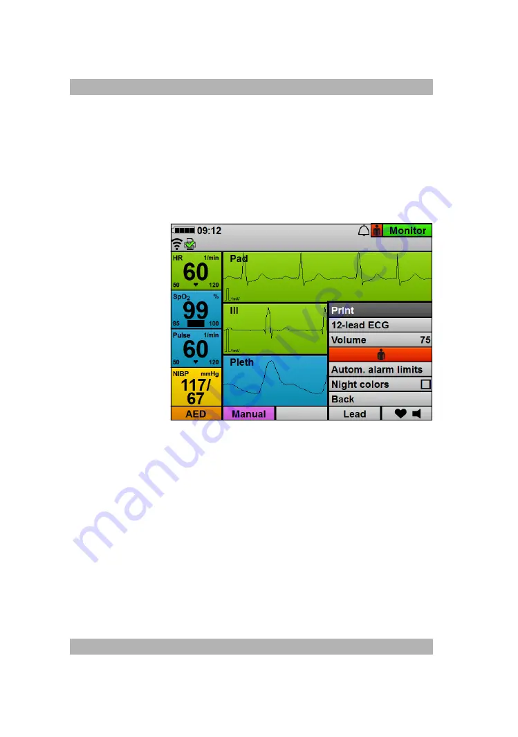 Weinmann MEDUCORE Standard2 Instructions For Use Manual Download Page 198