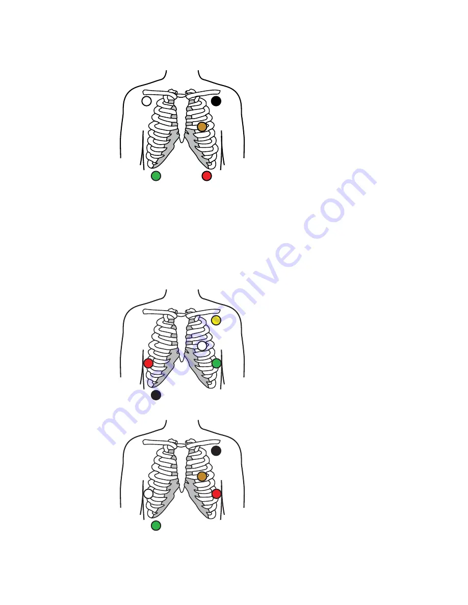 Welch Allyn Connex ECG Module Скачать руководство пользователя страница 25