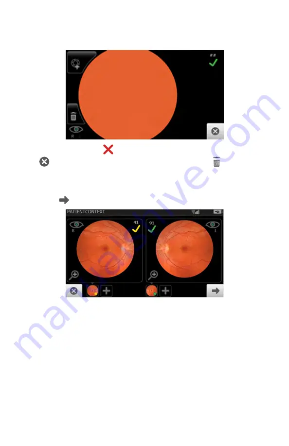 Welch Allyn RetinaVue 700 Скачать руководство пользователя страница 63