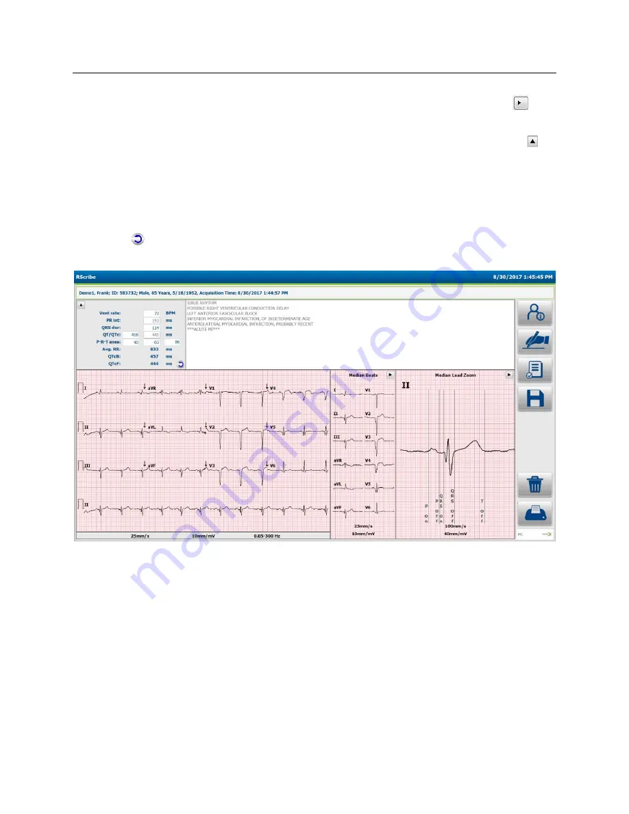 Welch Allyn RScribe Скачать руководство пользователя страница 60