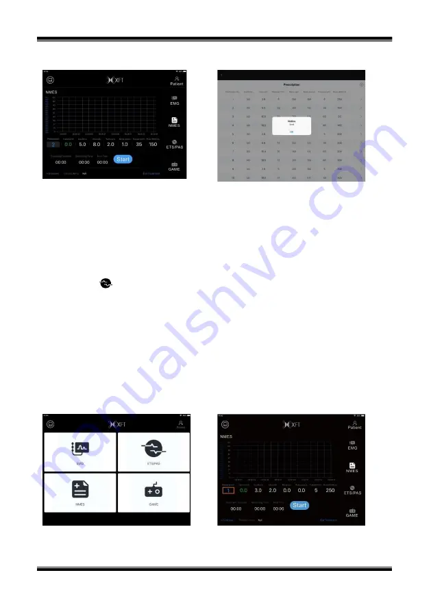 XFT Medical XFT-2003E User Manual Download Page 25