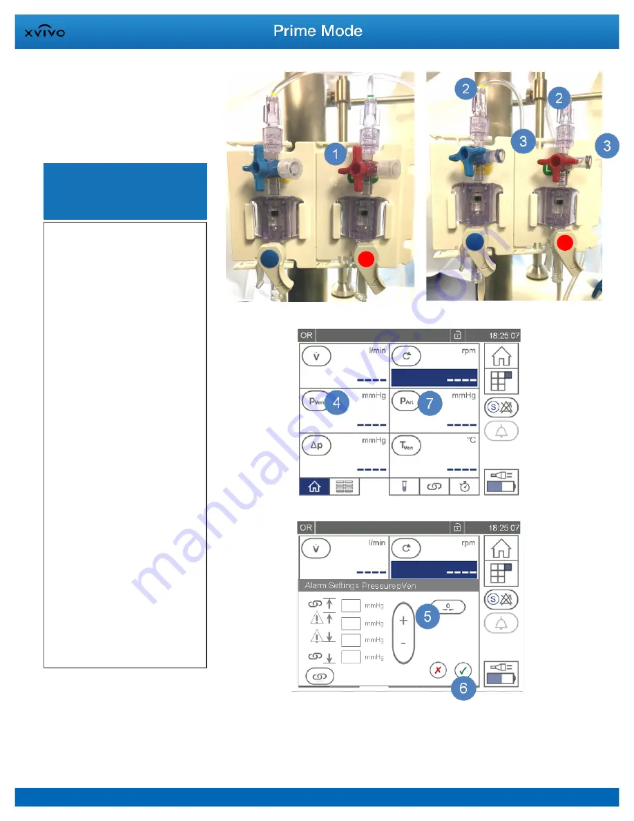 XVIVO XPS Instructions For Use Manual Download Page 38