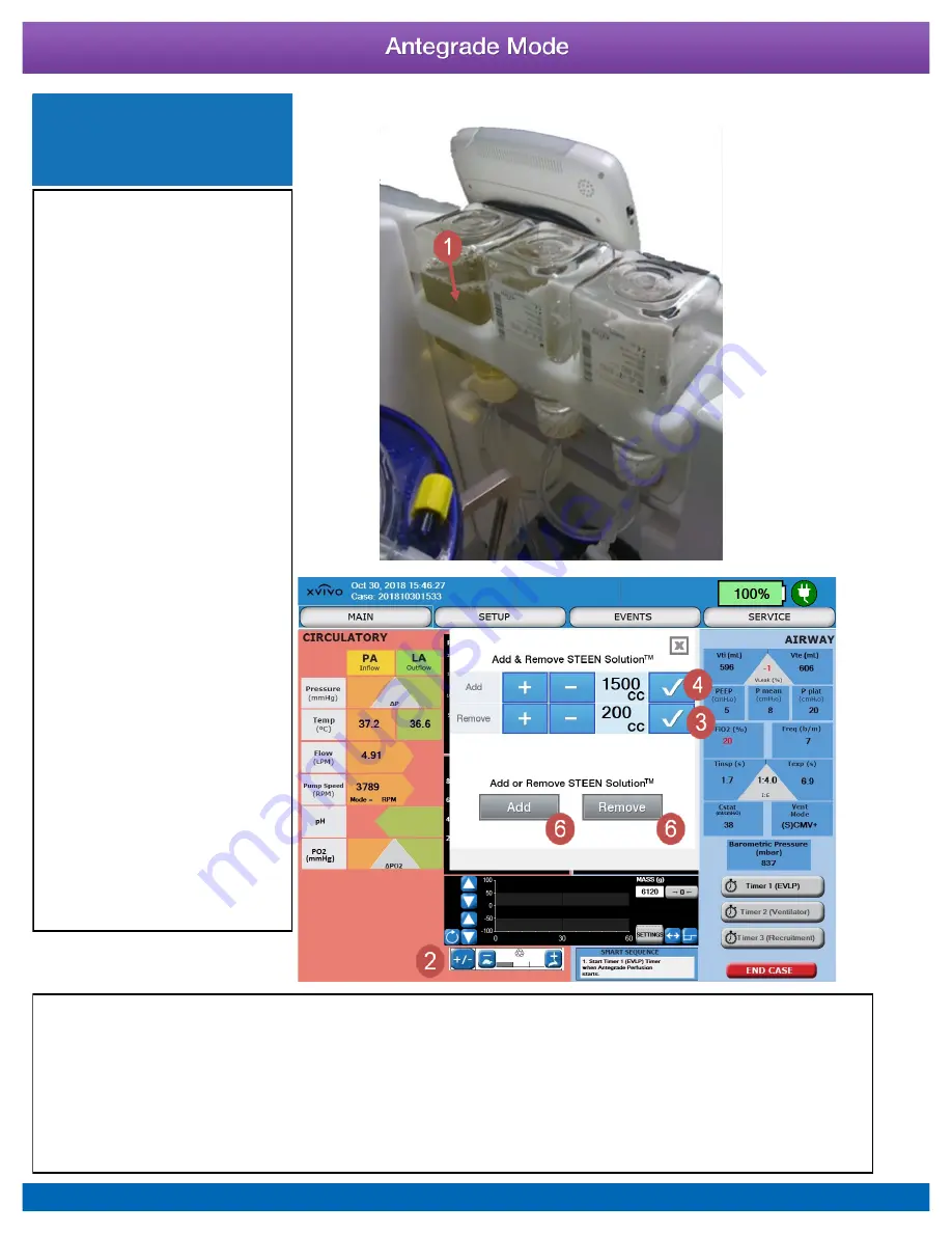 XVIVO XPS Instructions For Use Manual Download Page 52