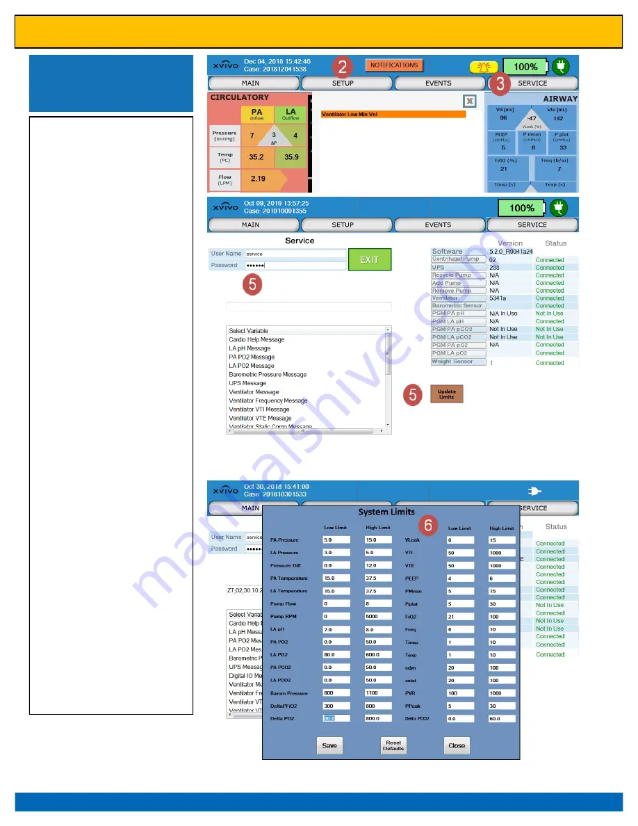 XVIVO XPS Instructions For Use Manual Download Page 64